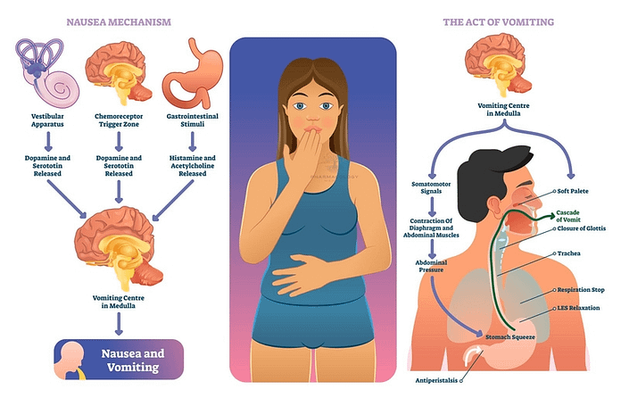 CTZ role in nausea and vomiting